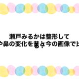瀬戸みるかは整形してる？目や鼻の変化を昔と今の画像で比較