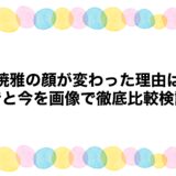 夏焼雅の顔が変わった理由は？昔と今を画像で徹底比較検証